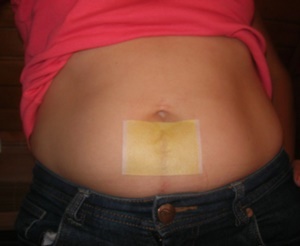 The experience of using the slimming patch Sliminazer